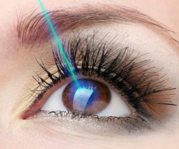 Eye Laser Treatment